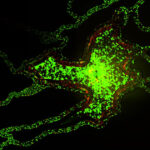 SynTumor -Endothelial Interactions