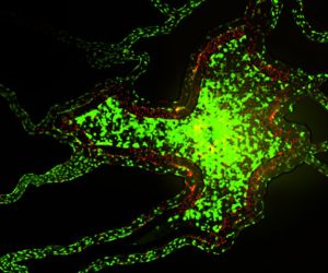 Syntumor cancer model