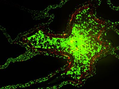 Syntumor cancer model