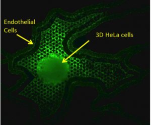 3Dtumor-hela