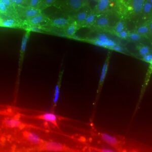 Endothelial-Astrocyte