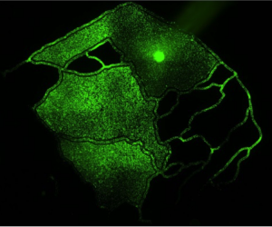 syntumor 3 chamber-metastasis