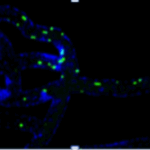 leukocyte endothelium interactions