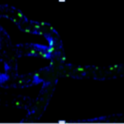 leukocyte endothelium interactions