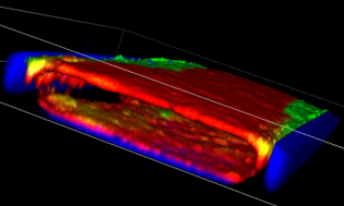3D model Lung_image