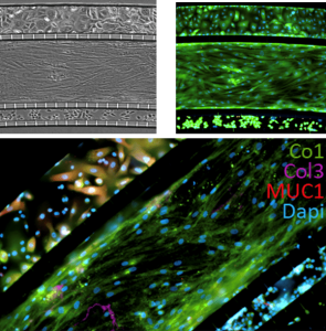 Cornea on chip co cultures of epithelial