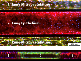Small Airway Lung Model