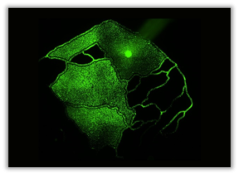 SynTumor Multi-chamber chips visualization