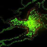 SynTumor -Endothelial Interactions